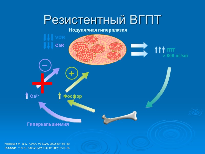 Нодулярная гиперплазия Резистентный ВГПТ VDR CaR Ca2+ Фосфор Гиперкальциемия Rodriguez M et al. Kidney